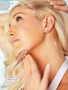 Heidi Montag Pratt surgery
