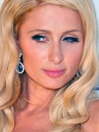 Paris Hilton lazy eyes